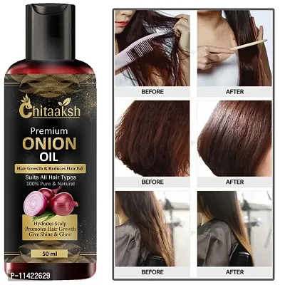 Hair Oil Onion For Hair Growth And Hair Fall Control Herbal Oil-50 Ml-thumb0