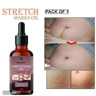 Stretch Marks Oil  Stretch Mark Oil For Women And Men - Scars, Uneven Skin Tone And Spots Removal Oil- 40 ml-thumb0