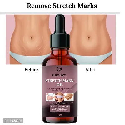 Stretch Marks Oil To Minimize Stretch Marks And Even Out Skin Tone- 40 ml-thumb0