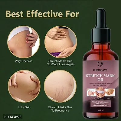 Stretch Marks Oil  Stretch Marks Oil To Reduce Stretch Marks Of Body, Belly, Thighs, Nourishment For Woman  40  ml-thumb0