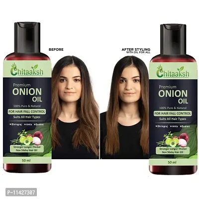 Onion Fast Hair Growth Oil - With Comb Applicator - New Lanch New Year Pack Of 2-thumb0