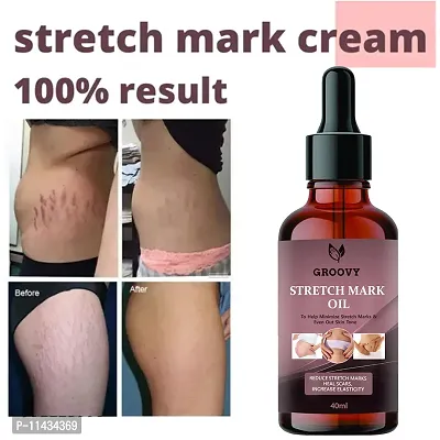 Stretch Marks Oil  After Delivery Stretch Mark Removal Oil 40 ml-thumb0