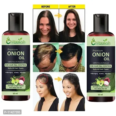 Onion Fast Hair Growth Oil - With Comb Applicator Pack Of 2-thumb0