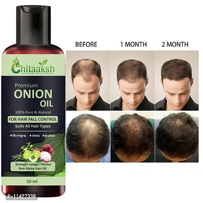 Onion Black Seed Hair Oil 50 Ml  For Men And Women-thumb0