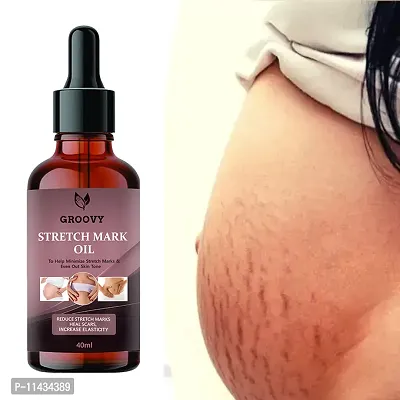 Stretch Marks Oil Body Care Oil - Scars, Pregnancy Stretch Mark,Ageing,Uneven Skin Tone 40 ml-thumb0