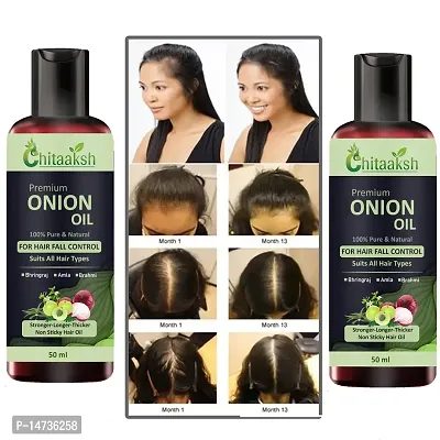 Red Onion Hair Oil - With Deep Root Hair Applicator - Controls HairFall  Promotes Growth - Hair Oil 50ml  PACK OF 2-thumb0