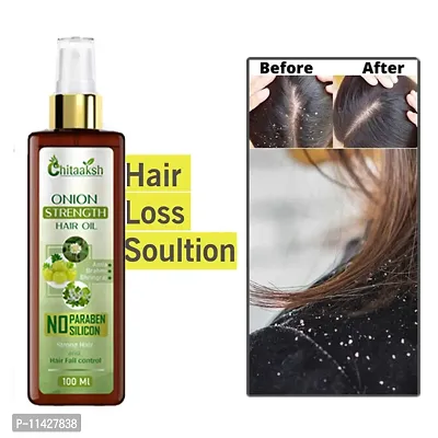 Chitaaksh Ayurveda Onion Hair Oil For Hair Growth And Hair Fall Control With 14 Essential Oils Hair Oil- 100 Ml-thumb0