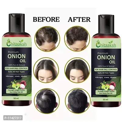 Red Onion Methi Hair Oil For Men And Women For Help To Reduce Hair Dandruff And Hair Growth 50 Ml Pack Of Pack Of 2-thumb0