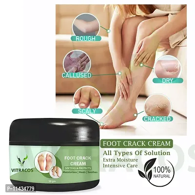 Foot Care Cream For Rough, Feet Cream For Heel Repair  - 50 Grams-thumb0