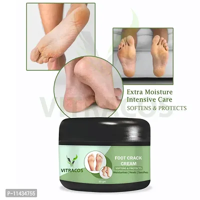 Foot Care Cream For Rough- 50 Grams