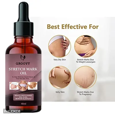 Stretch Marks Oil Soothing Scar And Stretch Mark Removal Oil  Pregnancy And Postpartum Safe  All-Natural, Paraben-Free- 40 ml-thumb0