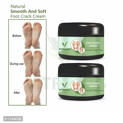 Foot Cream For Rough, Dry And Cracked Heel, Feet Cream For Heel Repair With Benefits- Pack Of 2, 50 Grams each each-thumb0