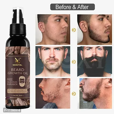 Nainital Advanced And Organic Beard Growth Oil For Strong And Healthy Beard Growth Organic Beard Oil Hair Oil -50 ml-thumb0