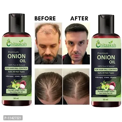 Onion Oil For Hair Regrowth Hair Oil  Combo 50 Ml Hair Oil Pack Of 2-thumb0