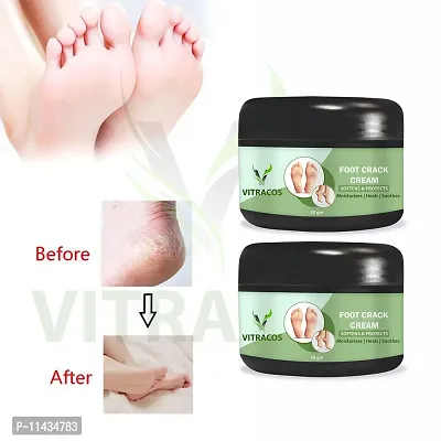 Foot Care Cream For Rough, Dry And Cracked Heel  Feet Cream For Heel Repair Healing And Softening Cream- Pack Of 2, 50 Grams each each