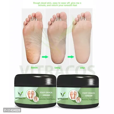 Pedicure And Manicure Citrus Hand And Foot Cream Masque- Pack Of 2, 50 Grams each