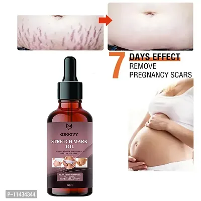 Stretch Marks Oil Skincare Oil For Pregnancy Stretch Marks With Argan Oil Saffron And Vitamin E Combo - 40 ml-thumb0