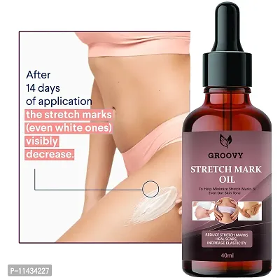 Therapy Oil For Stretch Marks, Scars And Skin Toning - 40 ml With Argan Oil-thumb0