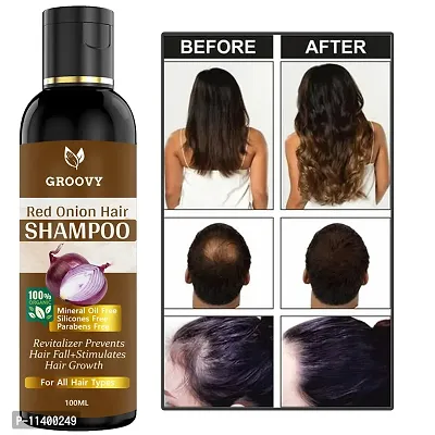 Onion Shampoo - Black Seed Onion Hair Shampoo Hair Shampoo- 100 ml-thumb0