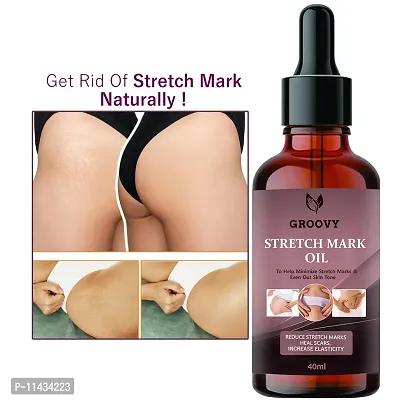 Stretch Mark Removal Oil Women And Men, Marks And Spots Removal- 40 ml-thumb0