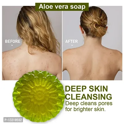 Handcrafted Aloe Vera Soap With Premium Ingredients For A Luxe Bathing Ritual -100 Grams-thumb0