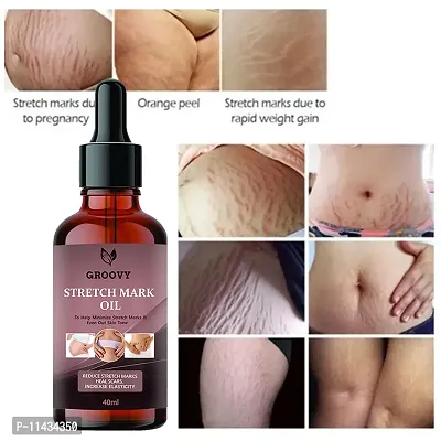 Stretch Marks Oil  Stretch Mark Oil With The Goodness Of Sea buckthorn Oil, Vitamin E And C, Lavender  All Skin Types  For Scars And Stretch Marks-40 ml-thumb0