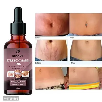 Stretch Marks Oil  Organics Natural Stretch Oil With Coconut, Yasti And Tilatel Oils, For Scars And Stretchmarks- 40 ml-thumb0