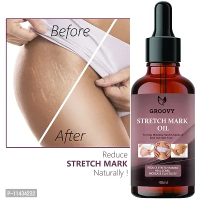 Stretch Mark Removal Oil For Men And Women- 40 ml-thumb0