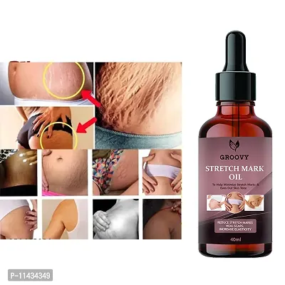 Stretch Marks Oil  Organics Natural Stretch Oil With Coconut, Yasti And Tilatel Oils, For Scars And Stretchmarks- 40 ml