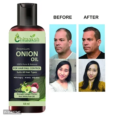 Hair Oil Black Seed Onion Oil For Damage Control, Hair Regrowth And Hair Fall Control -Men And Women Hair Oil 50 Ml-thumb0