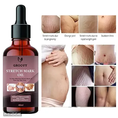 Stretch Marks Oil  Body Stretch Mark Removal Oil  Anti Aging  Pregnancy Stretch Mark Removal Oil Scar Removal  Anti Wrinkle  Skin Hydration -40 ml-thumb0