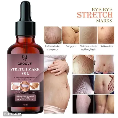 Present Stretch Marks Removal Oil - Natural Heal Pregnancy, , Legs, Mark Oil - 40 ml-thumb0