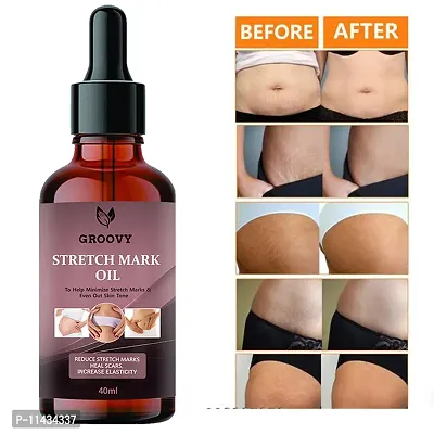 Stretch Marks Oil  Therapy Oil For Stretch Marks, Scars And Skin Toning - 40 ml With Argan Oil-thumb0