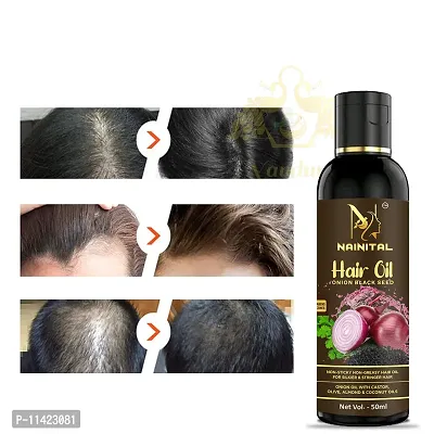 Hair Oil For Hair Growth For Men And Women 50 Ml For Men And Women -50 Ml-thumb0