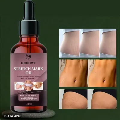 Stretch Marks Oil Stretch Mark And Scar Mark Removal Oil For Men And Women - 40 ml-thumb0