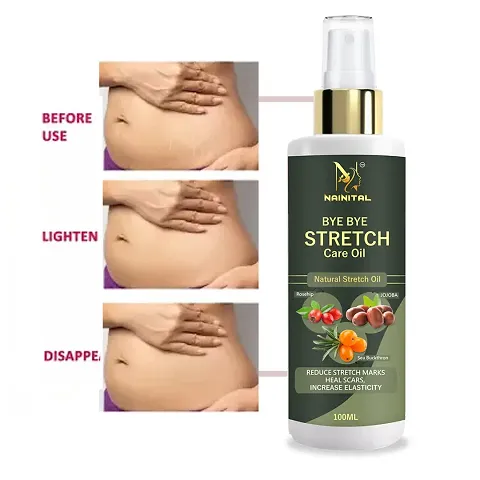 Nainital  Stretch Marks Scar Removal Cream Oil In During After Remover Scars- 100 ml - 100 ml