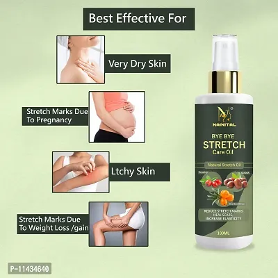 Nainital Anti Stretch Mark Removal Oil Women And Men, Marks And Spots Removal - 100 ml-thumb2