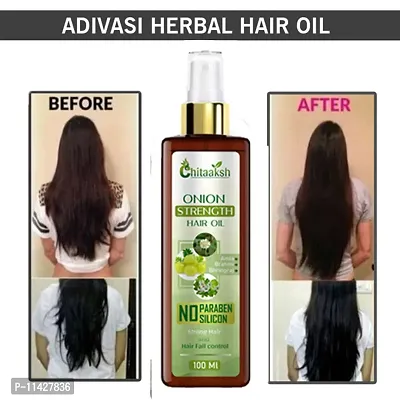 Chitaaksh Red Onion Black Seed Hair Oil - With Hair Oil- 100 Ml-thumb0