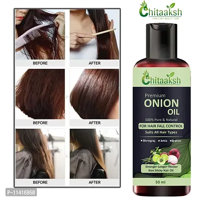 Hair Oil -50 Ml - Paraben, Sulphate Free-50 Ml  For Men And Women-thumb0