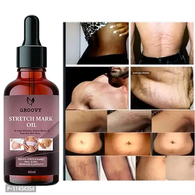 Stretch Marks Oil Advance Natural Stretch Oil For Scars And Stretchmarks- 40 ml-thumb0