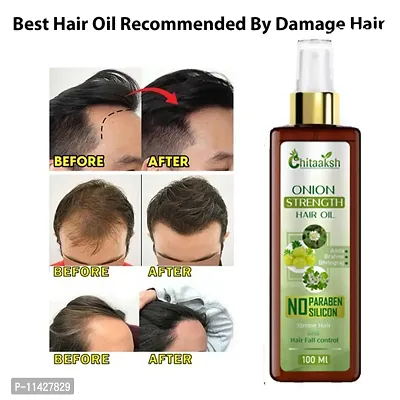 Chitaaksh Advanced Hair Oil With Redensyl For Men Strengthens Hair And Improves Hair Health Hair Oil- 100 Ml-thumb0