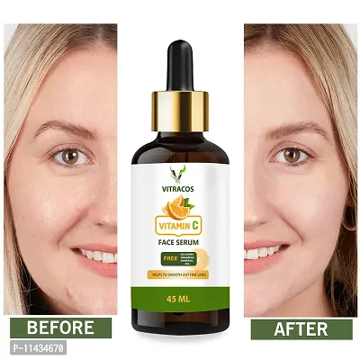 Vitracos Professional Vitamin C Face Serum - Skin Brightening Serum , Anti-Aging, Skin Repair, Supercharged Face Serum, Dark Circle, Fine Line And Sun Damage Corrector Face Serum 45  ml-thumb0