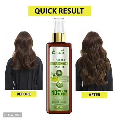 Chitaaksh Onion Herbal Hair Oil-thumb0