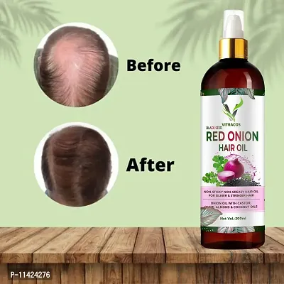 Premium Onion Methi-Fenugreek Oil Help For Rapid Hair Growth,Anti Hair Fall, Split Hair And Promotes Softer And Shinier Hair 200 Ml-thumb0