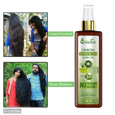 Chitaaksh Onion Hair Oil For Hair Growth,100 Ml-thumb0