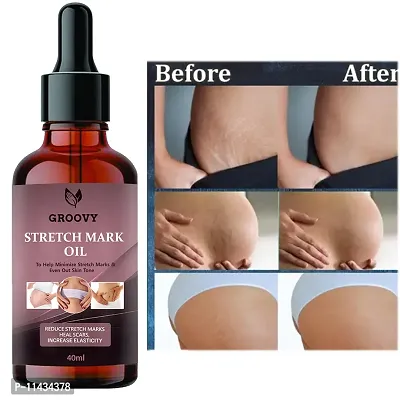 Stretch Marks Oil Ayurvedic Body Massage Bio Oil For Stretch Marks, Oil For Scar Removal, Aging And Wrinkled Skin- 40 ml-thumb0