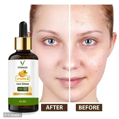 Vitracos Facial Serum - For All Skin Types - Fades Dark Spots - Minimizes Age Spots - Facial Serum For Dark Spots - Brightens Pigmentation And Brown Spots - Dermatologist Approved - 45 ml  45  ml-thumb0