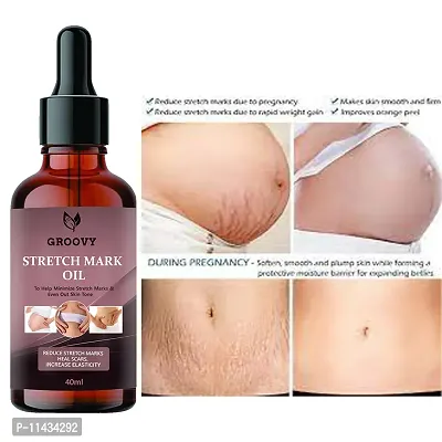 Stretch Marks Oil  Stretch Mark Oil With The Goodness Of Sea buckthorn Oil, Vitamin E And C, Lavender  All Skin Types  For Scars And Stretch Marks-40 ml-thumb0