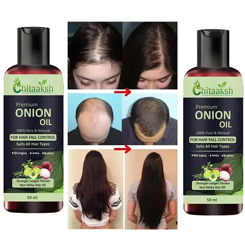 Chitaaksh Onion Hair Oil