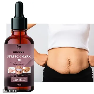 Stretch Marks Oil Body Care Oil - Scars, Pregnancy Stretch Mark,Ageing,Uneven Skin Tone 40 ml-thumb0